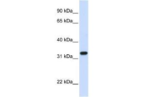 TBCB antibody used at 1 ug/ml to detect target protein.