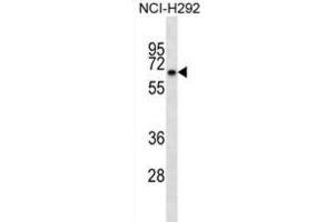 Western Blotting (WB) image for anti-Kelch-like protein 41 (KLHL41) antibody (ABIN2998754) (Kelch-like protein 41 (KLHL41) Antikörper)