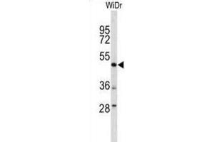Western Blotting (WB) image for anti-DEK Oncogene (DEK) antibody (ABIN3004071) (DEK Antikörper)