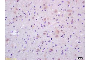 Formalin-fixed and paraffin embedded rat brain labeled with Rabbit Anti CDC37 Polyclonal Antibody, Unconjugated (ABIN706481) at 1:200 followed by conjugation to the secondary antibody and DAB staining