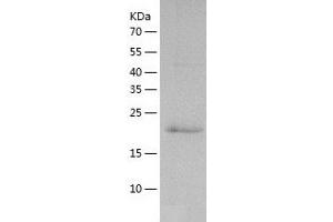 Western Blotting (WB) image for Vacuolar Protein-Sorting-Associated Protein 25 (VPS25) (AA 1-200) protein (His tag) (ABIN7125692)