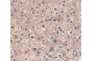 Used in DAB staining on fromalin fixed paraffin- embedded liver tissue (CD5 Antikörper  (AA 25-372))