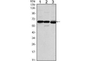 Western blot analysis using ESR1 mouse mAb against MCF-7 (1), T47D (2) and SKBR3 (3) cell lysate. (Estrogen Receptor alpha Antikörper)