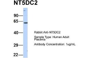 Host:  Rabbit  Target Name:  NT5DC2  Sample Type:  Human Adult Placenta  Antibody Dilution:  1. (NT5DC2 Antikörper  (N-Term))