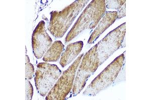 Immunohistochemistry (IHC) image for anti-CD47 (CD47) (AA 20-140) antibody (ABIN3022624)