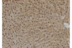 ABIN6272533 at 1/100 staining Rat liver tissue by IHC-P. (ZNF839 Antikörper  (Internal Region))