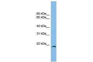 WB Suggested Anti-CIRBP Antibody Titration: 0. (CIRBP Antikörper  (Middle Region))