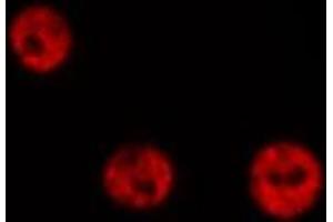 ABIN6267061 staining 293T  cells by IF/ICC.