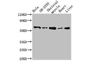Western Blot Positive WB detected in: Hela whole cell lysate, SH-SY5Y whole cell lysate, Mouse skeletal muscle tissue, Rat heart tissue, Rat liver tissue All lanes: ASNS antibody at 2. (Asparagine Synthetase Antikörper  (AA 364-551))