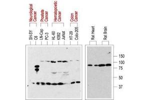 Western blot analysis of normal rat tissue (right) and in human cancer cell lines (left): - p75NTR is visualized with Anti-p75 NGF Receptor (extracellular) Antibody (ABIN7043344, ABIN7044755 and ABIN7044756), (1:200). (NGFR Antikörper  (Extracellular, Stalk Region))