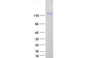 ERCC6 Protein (Myc-DYKDDDDK Tag)