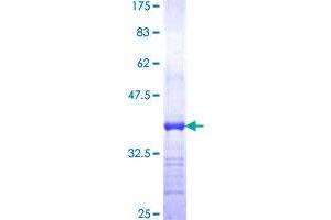 Peripherin Protein (PRPH) (AA 374-470) (GST tag)