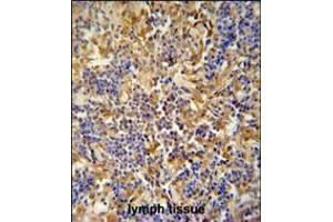 IBTK antibody immunohistochemistry analysis in formalin fixed and paraffin embedded human lymph tissue followed by peroxidase conjugation of the secondary antibody and DAB staining. (IBTK Antikörper  (AA 586-613))