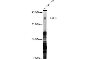 Western blot analysis of extracts of Mouse brain, using CDK12 antibody (ABIN7266230) at 1:1000 dilution. (CDK12 Antikörper  (AA 80-290))
