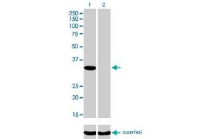 Western blot analysis of ITPK1 over-expressed 293 cell line, cotransfected with ITPK1 Validated Chimera RNAi (Lane 2) or non-transfected control (Lane 1). (ITPK1 Antikörper  (AA 1-314))