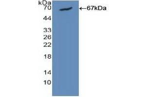 Detection of Recombinant CALM1, Human using Polyclonal Antibody to Calmodulin 1 (CALM1) (Calmodulin 1 Antikörper  (AA 1-149))