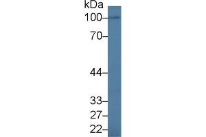 Western blot analysis of Human BXPC3 cell lysate, using Human IL17RA Antibody (1. (IL17RA Antikörper  (AA 377-534))