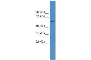 WB Suggested Anti-TTYH3 Antibody Titration:  0. (TTYH3 Antikörper  (Middle Region))