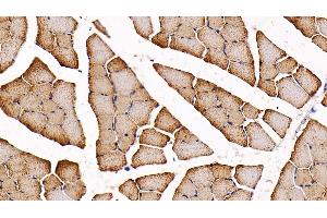 Immunohistochemistry (IHC) image for anti-Fatty Acid Binding Protein 3, Muscle and Heart (FABP3) (AA 1-133) antibody (ABIN7433315)
