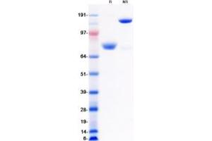 Western Blotting (WB) image for Receptor Tyrosine Kinase-Like Orphan Receptor 1 (ROR1) (Transcript Variant 1) protein (Fc Tag) (ABIN2731086)