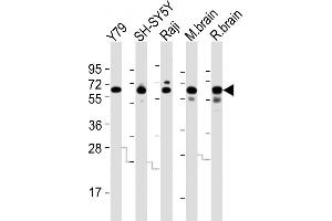 All lanes : Anti-DPYSL5 Antibody (C-term) at 1:2000 dilution Lane 1: Y79 whole cell lysates Lane 2: SH-SY5Y whole cell lysates Lane 3: Raji whole cell lysates Lane 4: mouse brain lysates Lane 5: rat brain lysates Lysates/proteins at 20 μg per lane. (DPYSL5 Antikörper  (C-Term))