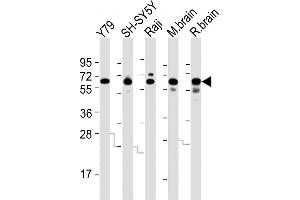 All lanes : Anti-DPYSL5 Antibody (C-term) at 1:2000 dilution Lane 1: Y79 whole cell lysates Lane 2: SH-SY5Y whole cell lysates Lane 3: Raji whole cell lysates Lane 4: mouse brain lysates Lane 5: rat brain lysates Lysates/proteins at 20 μg per lane.