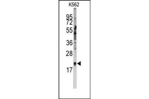 Image no. 1 for anti-Small Nuclear Ribonucleoprotein Polypeptide C (SNRPC) (C-Term) antibody (ABIN358016) (SNRPC Antikörper  (C-Term))