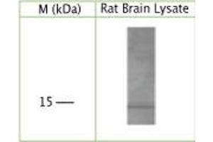 WB on rat brain lysate using Sheep antibody to human, rat, mouse GABA(A) receptor-associated protein (GABARAP, MM46, FLC3B): IgG at a concentration of 5 µg/ml under reducing condition. (GABARAP Antikörper)