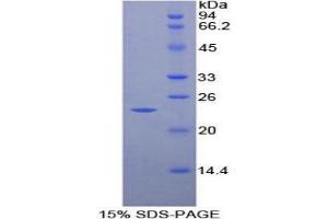SDS-PAGE (SDS) image for Matrix Metallopeptidase 9 (Gelatinase B, 92kDa Gelatinase, 92kDa Type IV Collagenase) (MMP9) protein (ABIN1880145)