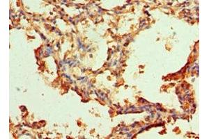 Immunohistochemistry of paraffin-embedded human lung tissue using ABIN7143754 at dilution of 1:100 (SERPINA3 Antikörper  (AA 24-423))