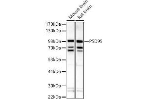 Western blot analysis of extracts of various cell lines, using PSD95 antibody (ABIN6134334, ABIN6139650, ABIN7101791 and ABIN7101792) at 1:500 dilution. (DLG4 Antikörper  (AA 1-100))