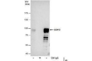 IP Image Immunoprecipitation of SOX13 protein from NT2D1 whole cell extracts using 5 μg of SOX13 antibody [N1C3], Western blot analysis was performed using SOX13 antibody [N1C3], EasyBlot anti-Rabbit IgG  was used as a secondary reagent. (SOX13 Antikörper)