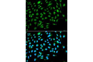 Immunofluorescence analysis of A549 cells using ING3 antibody. (ING3 Antikörper)