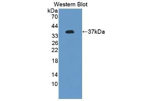 Western Blotting (WB) image for anti-Heme Oxygenase (Decycling) 1 (HMOX1) (AA 1-289) antibody (ABIN5013681)