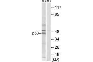 Western blot analysis of extracts from 293 cells, using p53 (Ab-378) antibody. (p53 Antikörper  (Ser378))