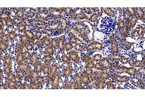 Immunohistochemistry (IHC) image for anti-Endothelial PAS Domain Protein 1 (EPAS1) (AA 21-336) antibody (ABIN7435526)