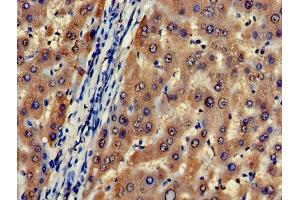 Immunohistochemistry (IHC) image for anti-Cytidine Deaminase (CDA) (AA 1-146) antibody (ABIN7149082)