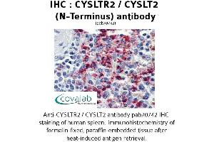 Image no. 2 for anti-Cysteinyl Leukotriene Receptor 2 (CYSLTR2) (N-Term) antibody (ABIN1733466) (CasLTR2 Antikörper  (N-Term))