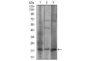 Western blot analysis using CAV2 mouse mAb against A549 (1), 3T3-L1 (2), A431 (3) cell lysate. (Caveolin 2 Antikörper  (AA 1-86))