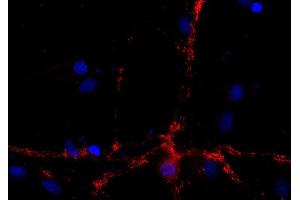 Indirect immunostaining of PFA fixed rat hippocampus neurons (dilution 1 : 500; red). (DNAJC5 Antikörper)