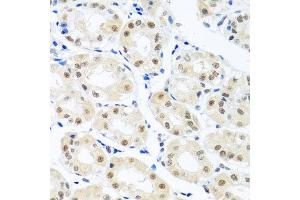 Immunohistochemistry of paraffin-embedded human stomach using THOC1 antibody at dilution of 1:100 (x40 lens).