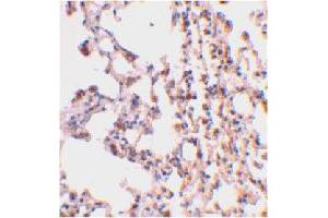 Immunohistochemical staining of mouse lung tissue using BID polyclonal antibody  at 2 ug/mL .