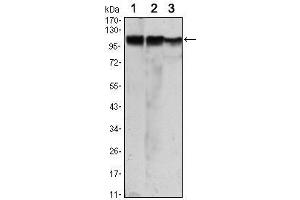 Western Blot showing HK2 antibody used against Jurkat (1), Hela (2) and HEK293 (3) cell lysate.