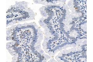 ABIN6263604 and ABIN6272967 at 1/100 staining Rat colon tissue by IHC-P.