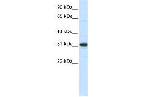WB Suggested Anti-NRIP2 Antibody Titration:  0. (NRIP2 Antikörper  (N-Term))