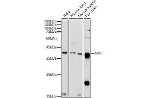 Western blot analysis of extracts of various cell lines, using MR1 antibody (ABIN6131925, ABIN6143983, ABIN6143984 and ABIN6224070) at 1:1000 dilution. (MR1 Antikörper  (AA 20-260))