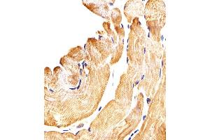 Immunohistochemical analysis of paraffin-embedded H. (SMAD1 Antikörper  (AA 163-196))