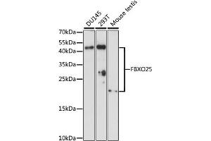 Western blot analysis of extracts of various cell lines, using FBXO25 antibody (ABIN7267087) at 1:1000 dilution. (FBXO25 Antikörper  (AA 142-291))