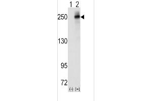 Western blot analysis of ALK(Center)(arrow) using rabbit polyclonal ALK(Center) Antibody (ABIN6243477 and ABIN6579002). (ALK Antikörper  (AA 636-666))