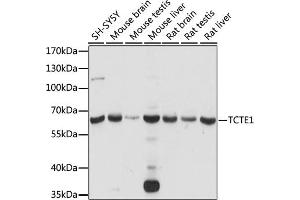 Western blot analysis of extracts of various cell lines, using TCTE1 antibody (ABIN7270710) at 1:1000 dilution. (TCTE1 Antikörper  (AA 1-300))